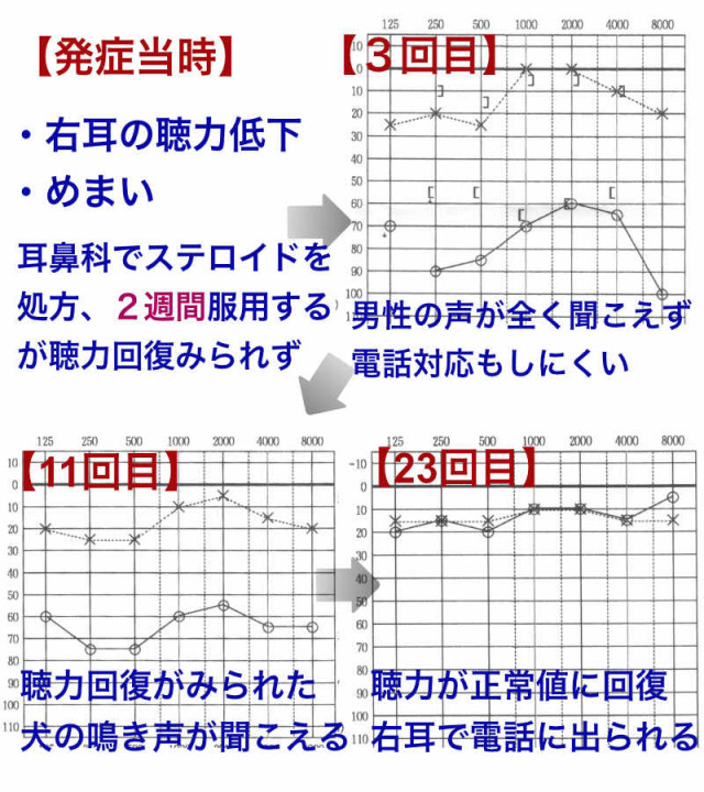 改善の兆しの画像