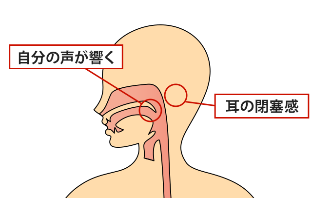 症状の該当箇所のイラスト