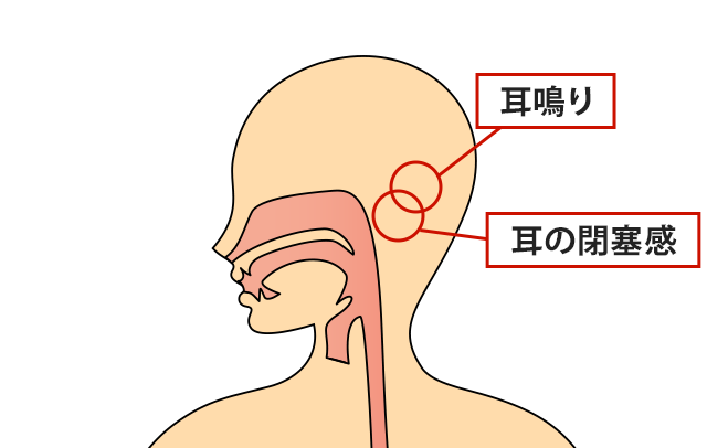症状の該当箇所のイラスト